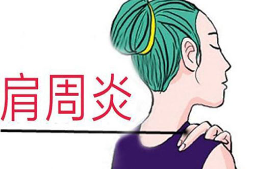 �������ܺȾ��� ���ڼ����׵�4������